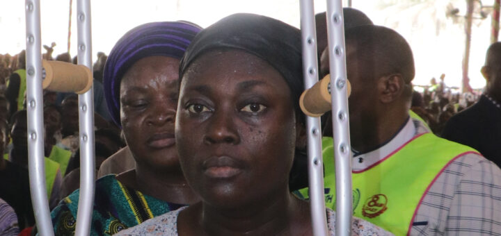 Evil projection in breast exorcised