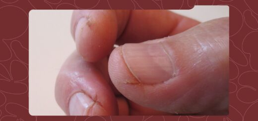 We Found the Best Fixes for Cracked Hands (and They’re Affordable)