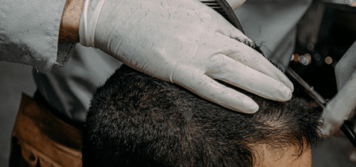 The Secret to Affordable Celebrity Hair: How Much Is a Top-End Hair Transplant in Turkey?