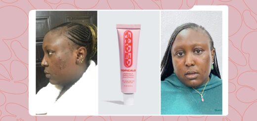 Why I’m Adding Topicals Faded to My Skincare Routine After A Month